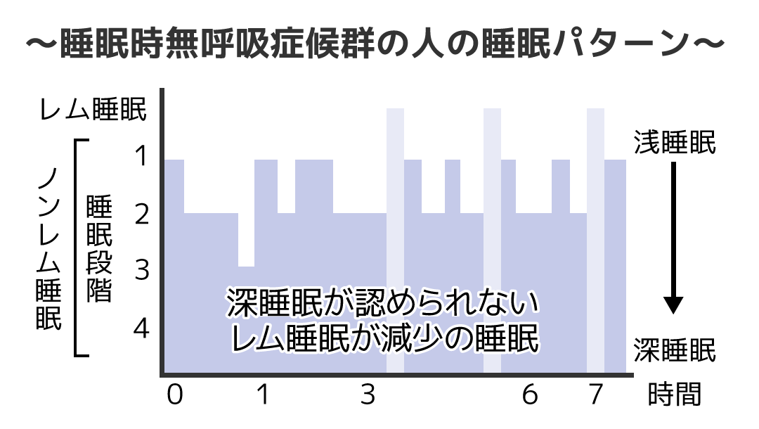 睡眠時無呼吸症候群の人の睡眠パターン